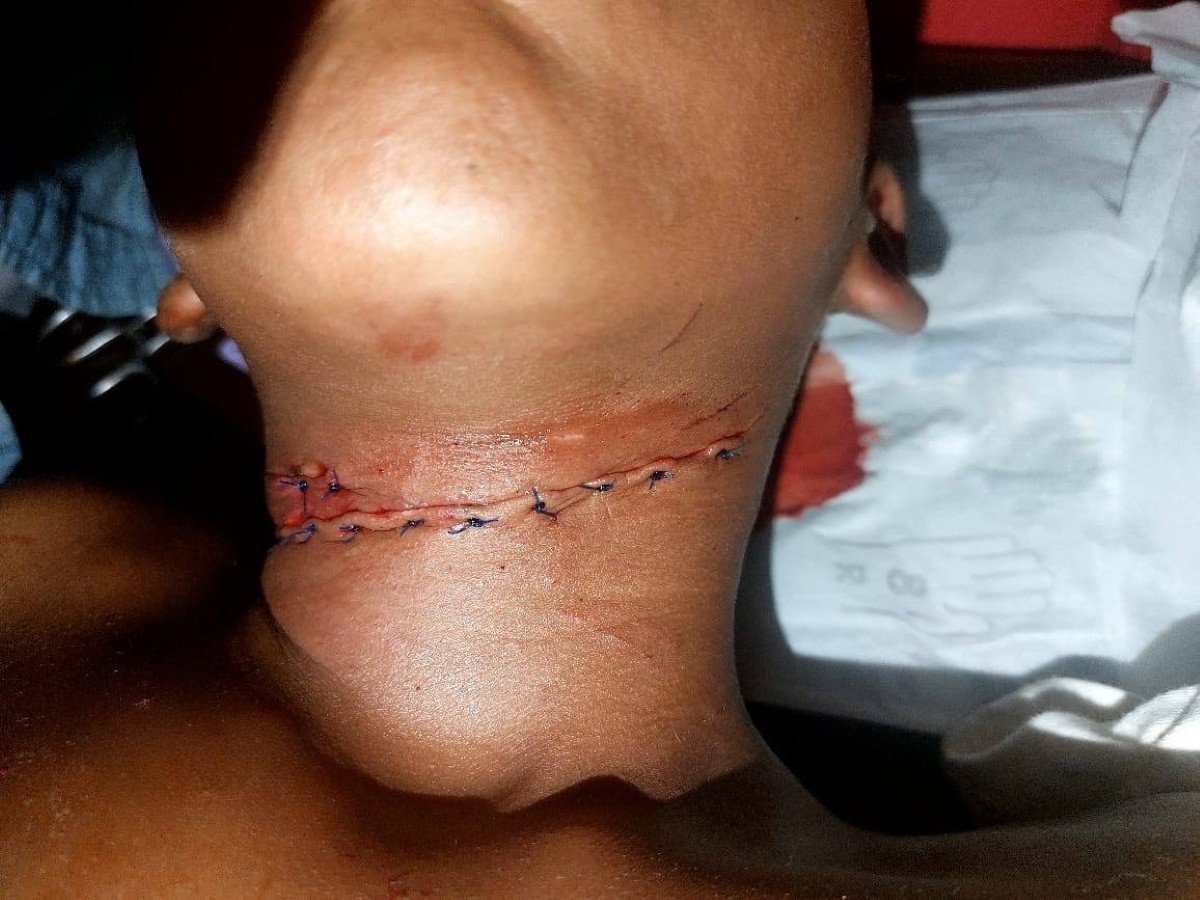 Niño herido por un tigre en Nicaragua: ¿Qué sucedió?