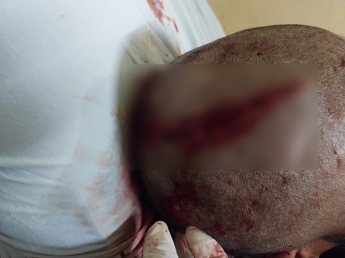 Agresión en San Carlos: Benjamín Blandón herido grave