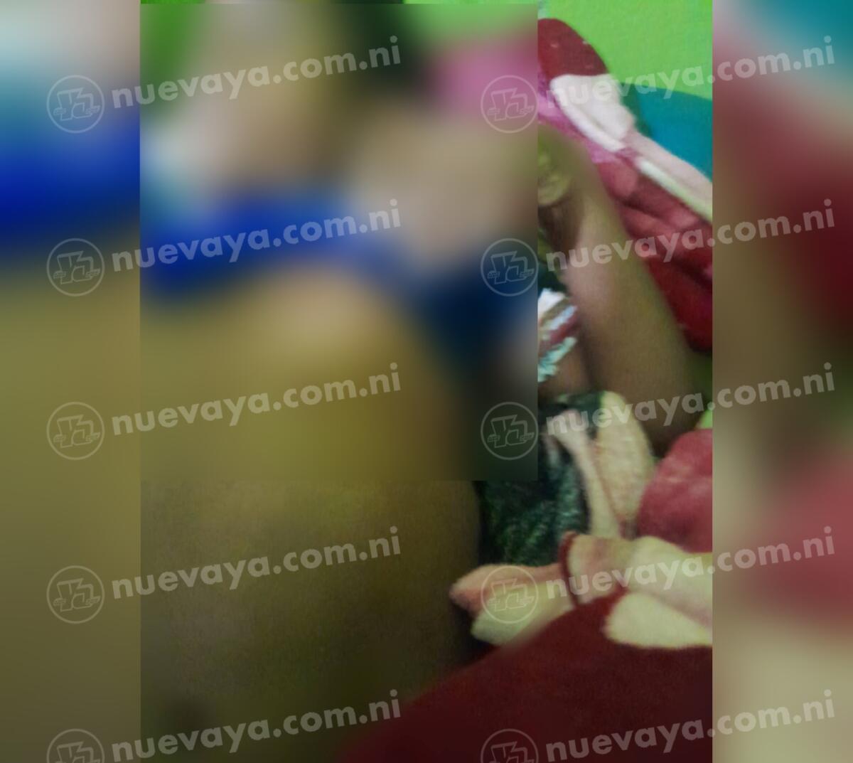 Niño de 11 años baleado en Waspam: Investiga la policía