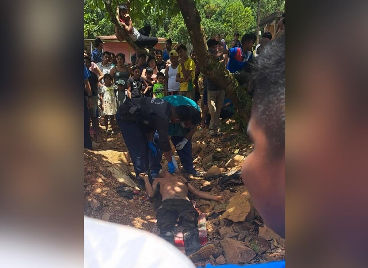 Joven sufre quemaduras tras descarga eléctrica en Estelí
