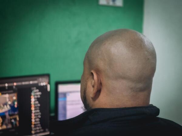 Descubren una relación entre la caída del cabello y las bebidas azucaradas