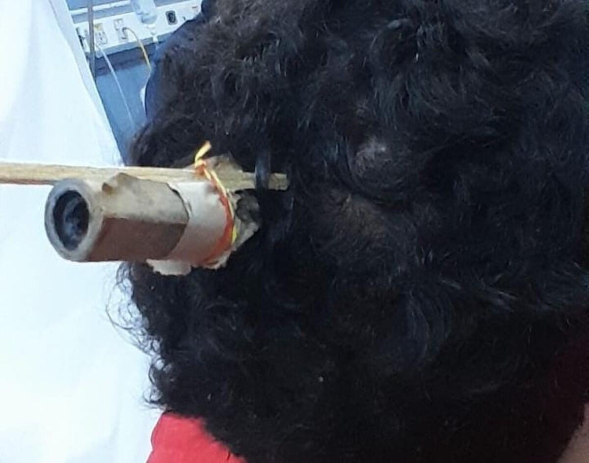 Lesionado resultó el bombero Francisco David Aragón Blandón