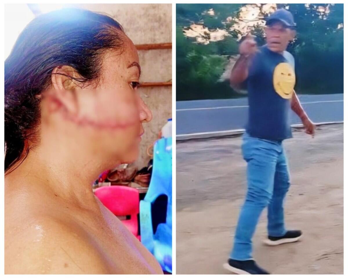 La señora Marvela Marín sobrevive a un intento de homicidio en Mozonte