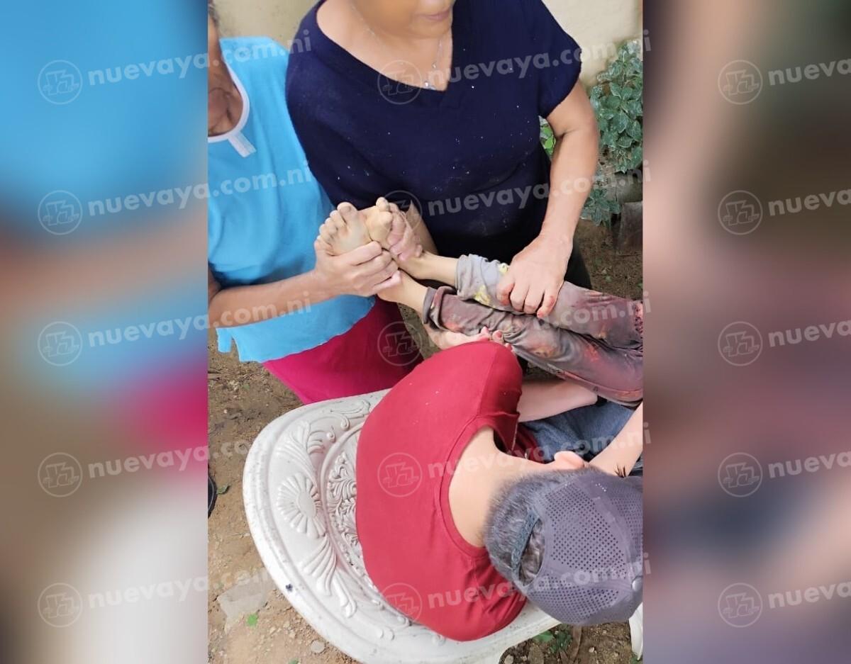 Un niño de tan sólo 6 años resultó gravemente herido por la explosión de un artefacto en Nueva Segovia
