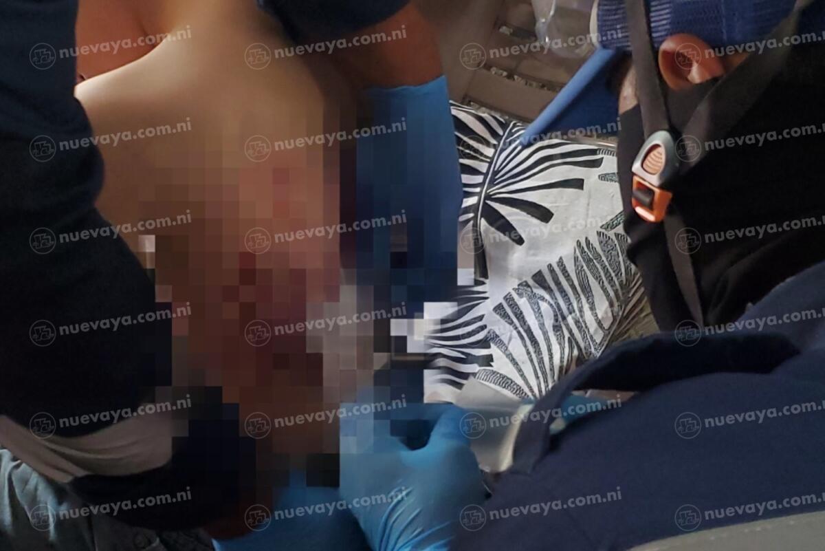 Niño de 9 años atacado por perros en Estelí