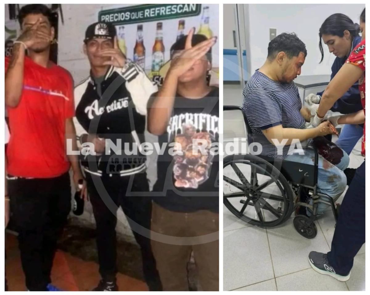 Policía captura a agresores de Obed Salmerón en Chichigalpa