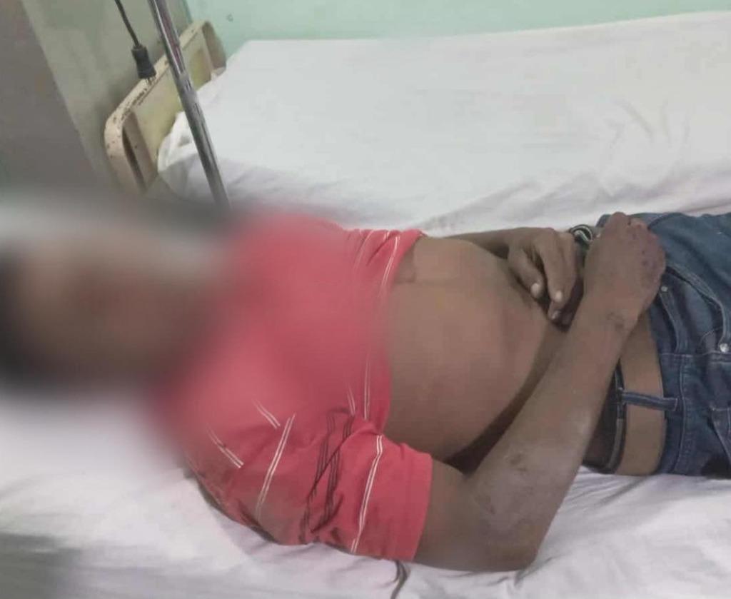 Trágico accidente de moto en Larreynaga – Malpaisillo