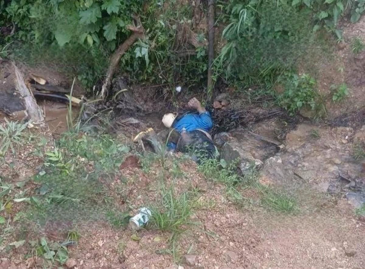 Muere vecino de Chachagua por trauma craneal severo