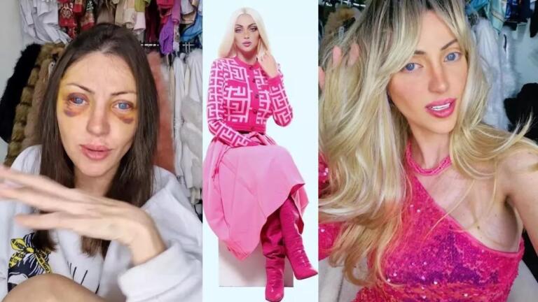 Muere en extrañas circunstancias una «barbie humana» que se sometió a 27 cirugías estéticas