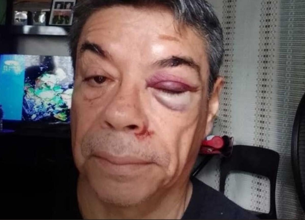El DJ Oscar Alvarado sufre violento asalto en Managua