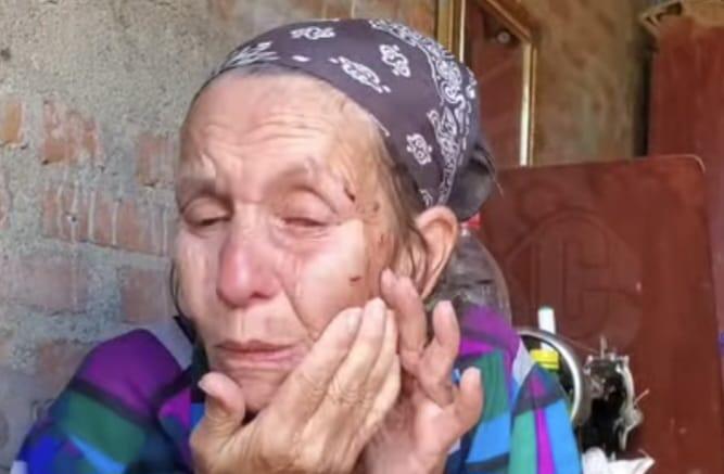 Adulta mayor es atacada por perro pitbull, en Estelí