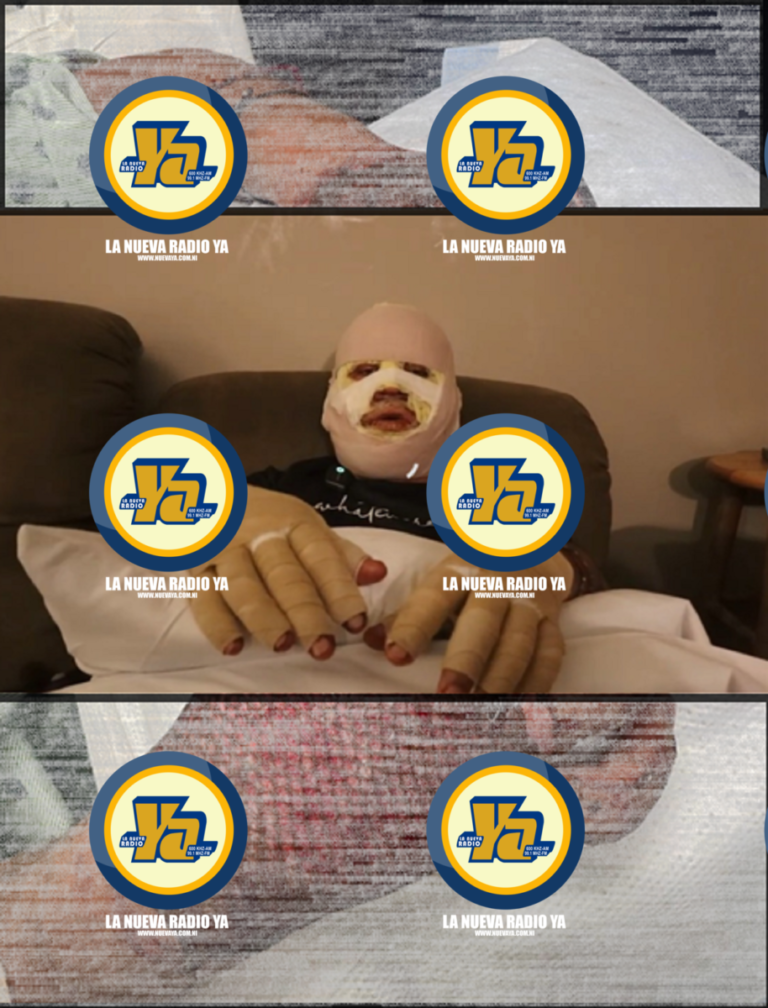 Jinotegano sufre graves quemaduras tras ataque incendiario a su negocio en Indianápolis, Estados Unidos