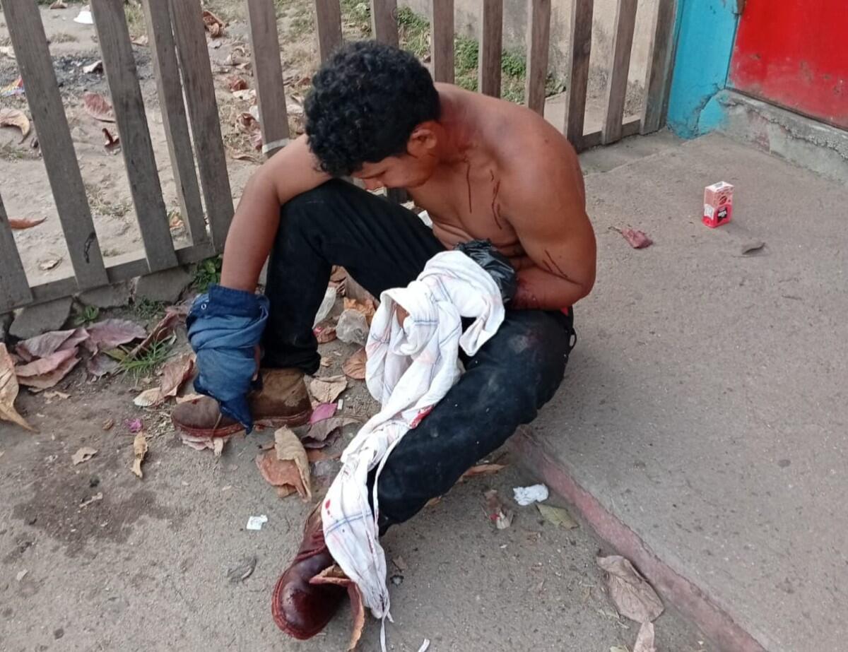 Joven herido tras intento de robo en Estelí
