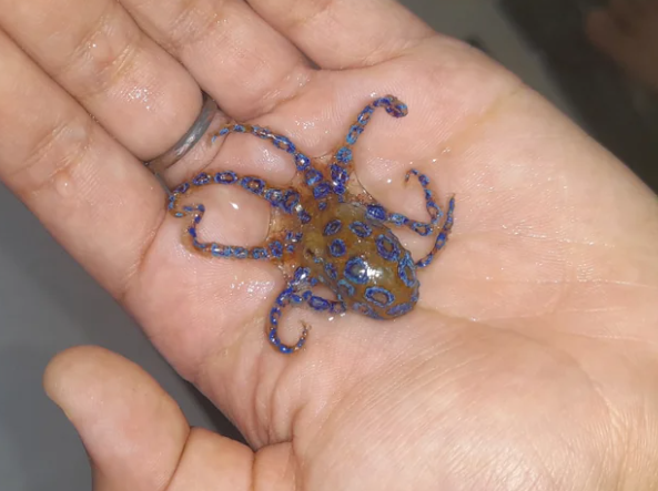 Turista fue mordido por pulpo en Australia, estuvo 20 días en coma