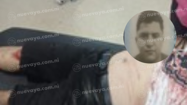 Bonanza: motorizado pierde la vida al impactar contra punto fijo