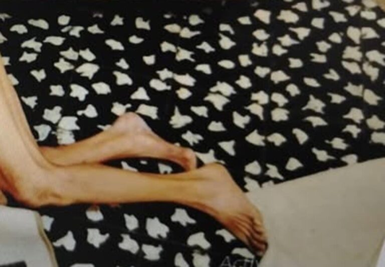 Managua: encuentran sin vida a señor de 74 años en el barrio Monseñor Lezcano