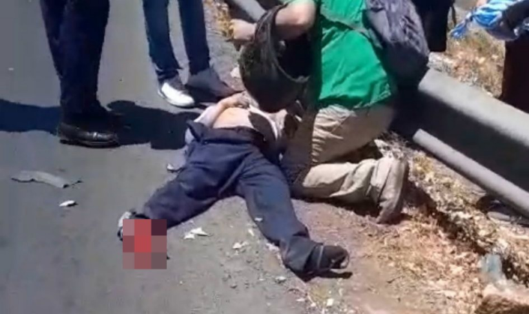 Menor al borde de la muerte tras ser atropellado por camioneta en Carretera a Masaya