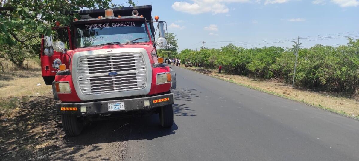 Moto explota en choque contra volquete, joven resulta con piernas quebradas