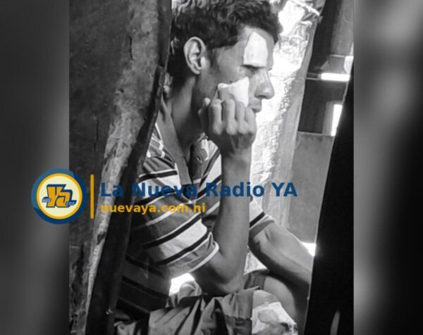 Rudy Huerta Bravo fallece días después de ser atropellado en Juigalpa