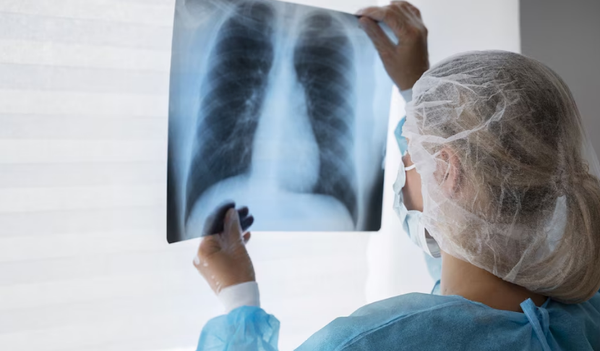 El Salvador reporta más de 5,500 hospitalizaciones por neumonía