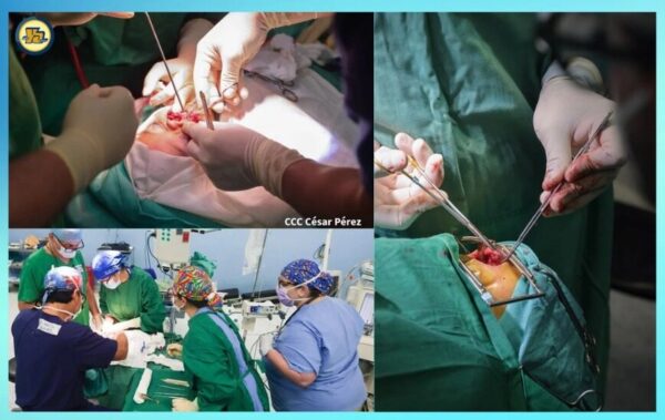 Operarán a 52 niños con labio leporino en el Hospital Vélez Páiz