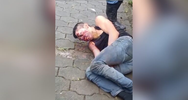 Hombre oriundo de Las Minas es asaltado y brutalmente golpeado en Chontales